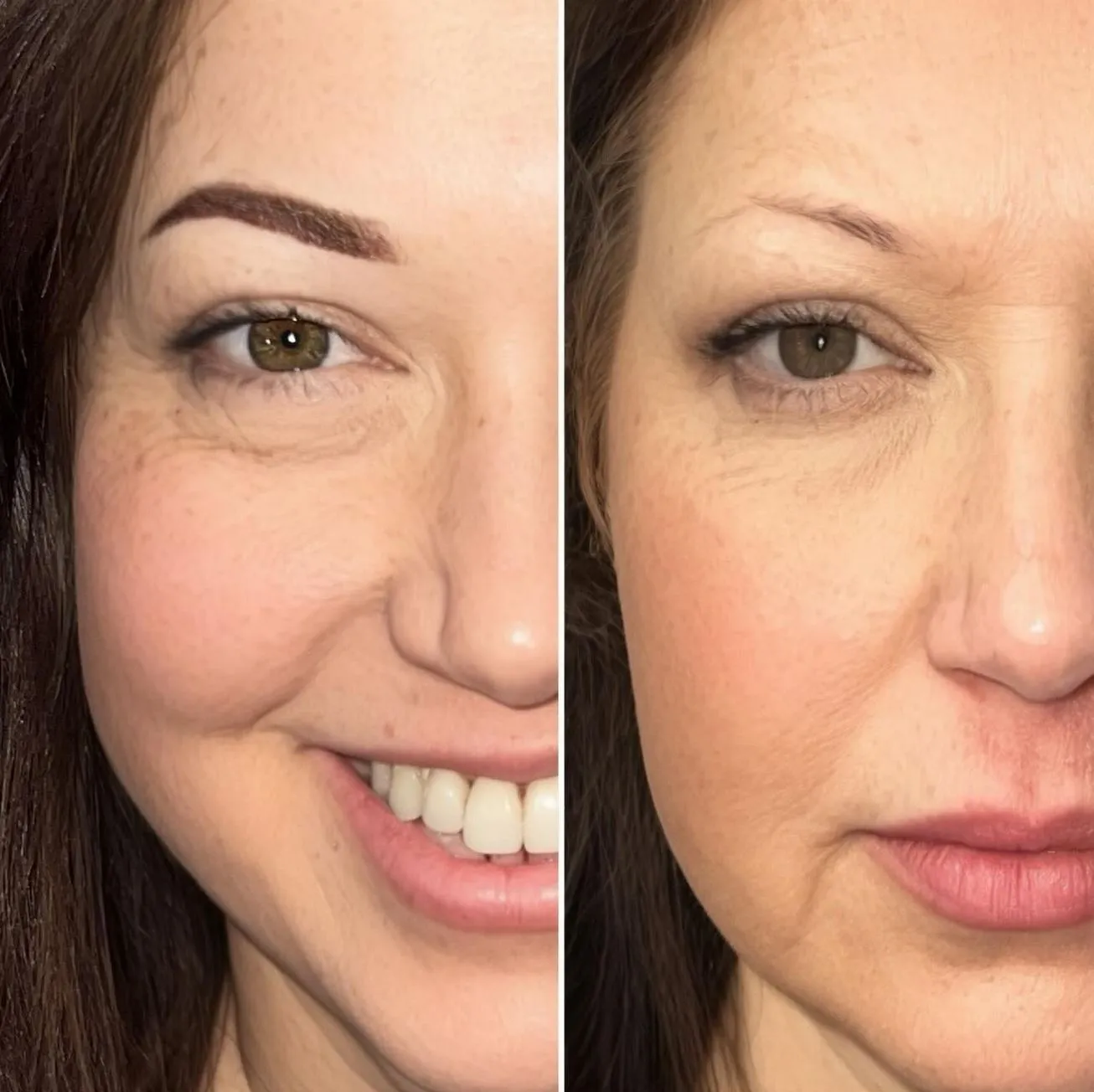 Ombré vs Combo Brows, Does It Change the Price